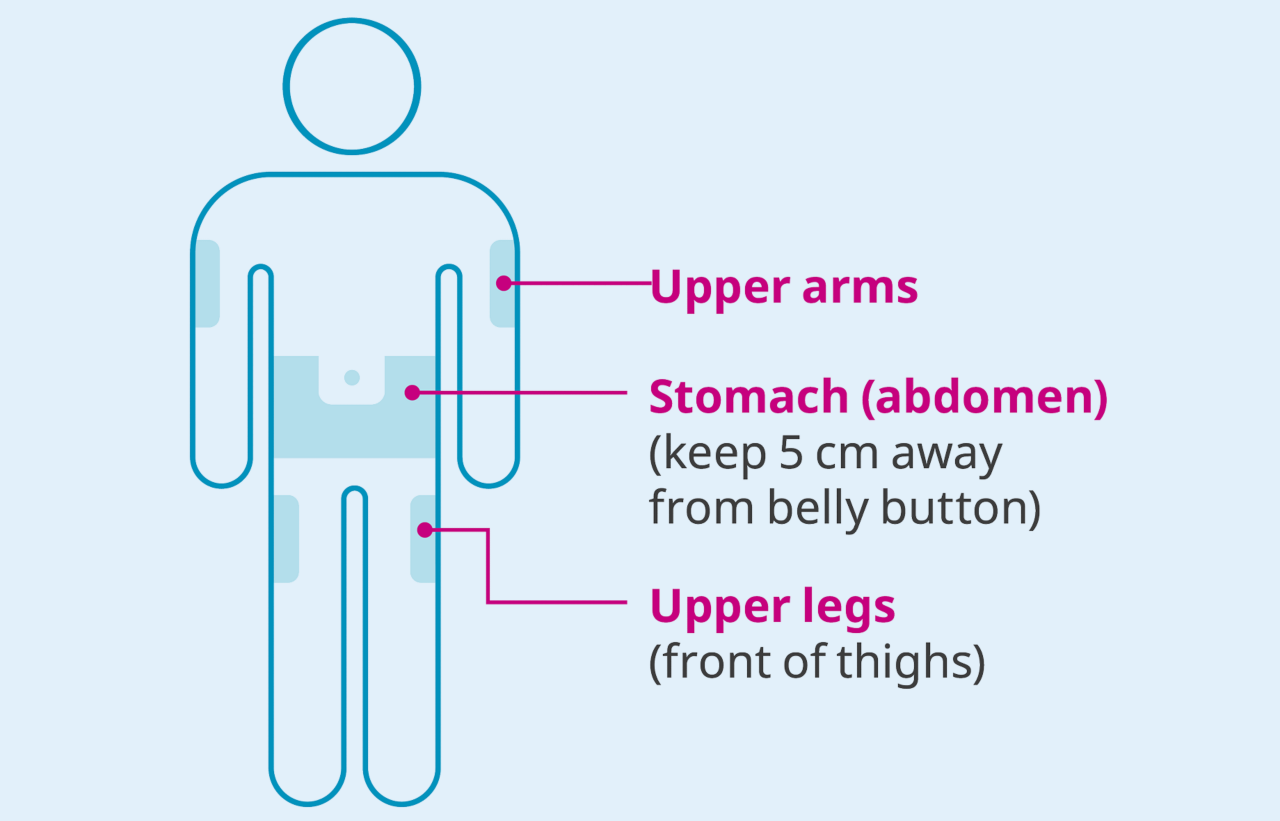 Injection site diagram